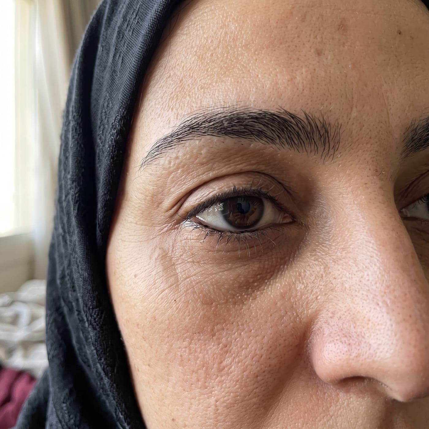 خطوط دقيقة وفقدان المرونة